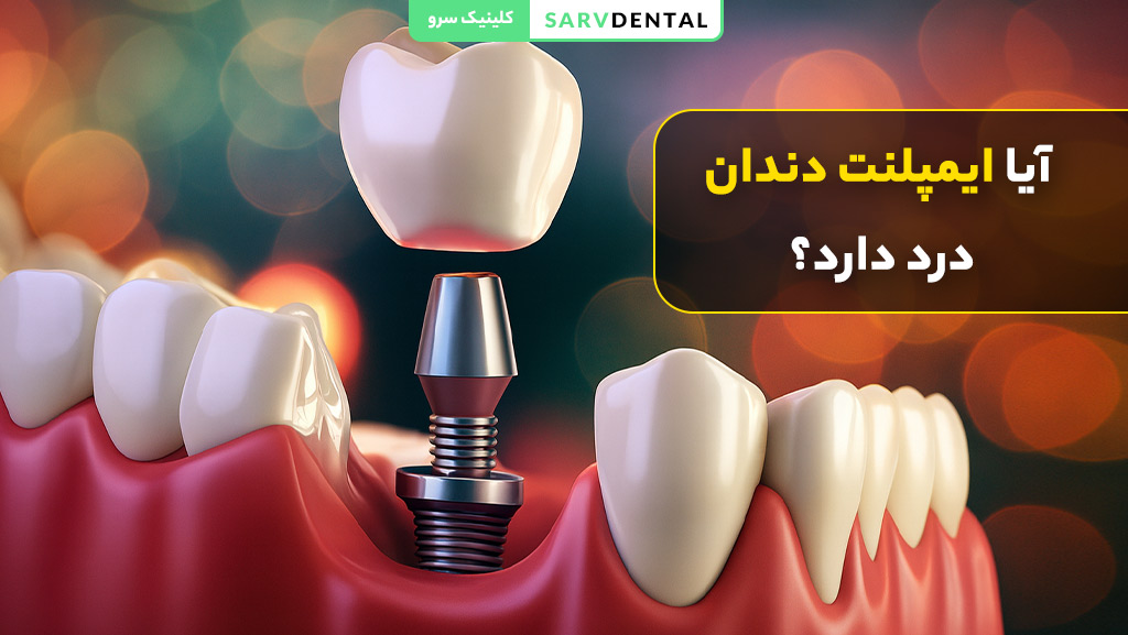 does dental implant hurt