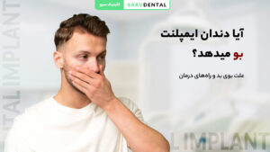 آیا ایمپلنت دندان باعث بوی بد دهان می‌شود؟ بررسی علت بوی بد ایمپلنت