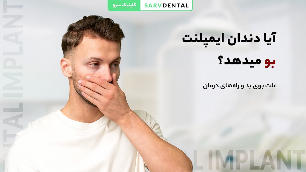 آیا ایمپلنت دندان باعث بوی بد دهان می‌شود؟ بررسی علت بوی بد ایمپلنت