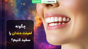 روش‌های موثر سفید کردن لمینت دندان