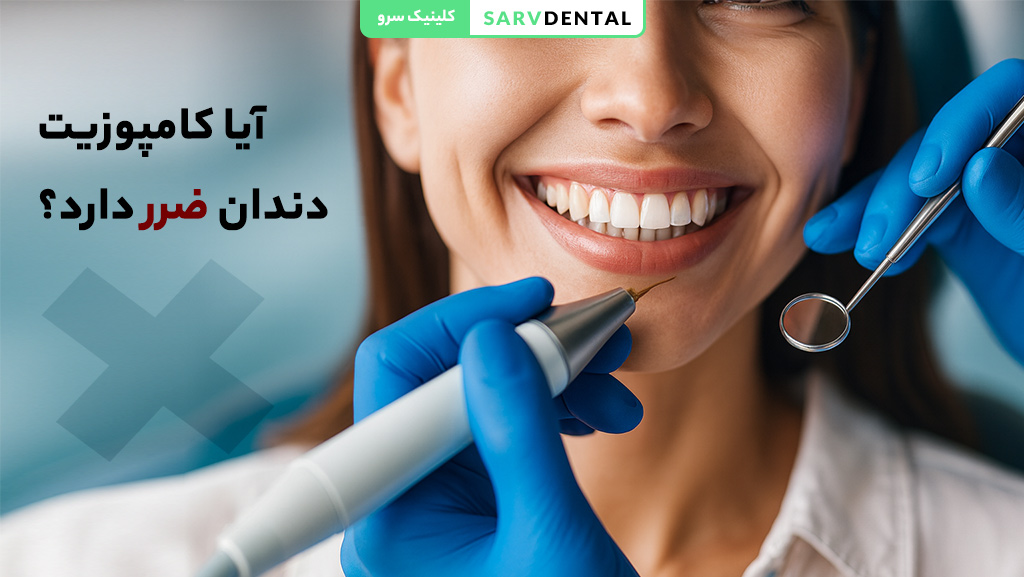 بررسی معایب و عوارض احتمالی کامپوزیت دندان