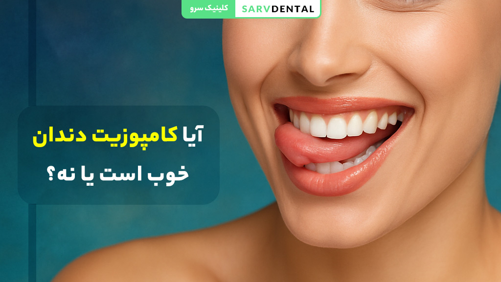 آیا کامپوزیت دندان خوب است یا نه