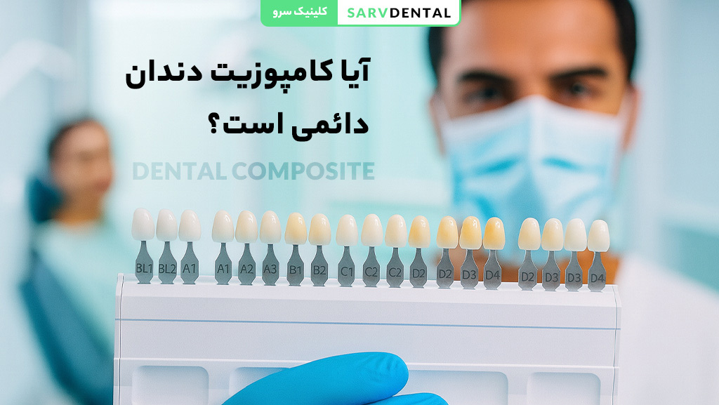 آیا کامپوزیت دندان دائمی است؟ ماندگاری و طول عمر کامپوزیت دندان
