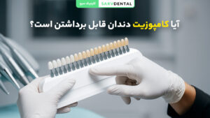 آیا کامپوزیت دندان قابل برداشتن است؟