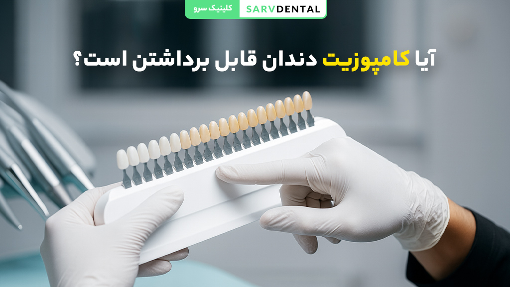 آیا کامپوزیت دندان قابل برداشتن است؟