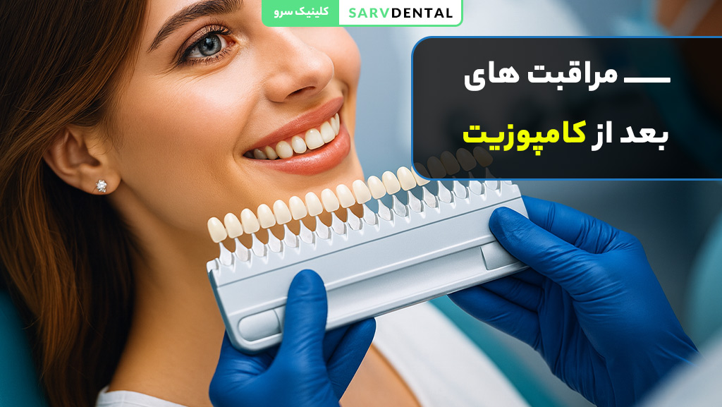مراقبت های بعد از کامپوزیت ونیر و لیرینگ