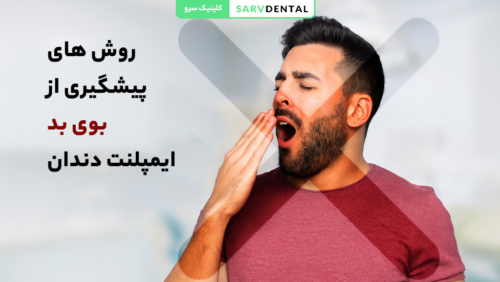 روش های پیشگیری از بوی بد ایمپلنت دندان و مراقبت بعد از ایمپلنت