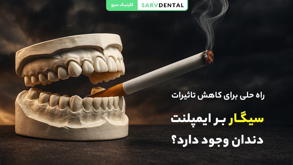راهکارهای کاهش تاثیر سیگار بر ایمپلنت دندان و افزایش ماندگاری