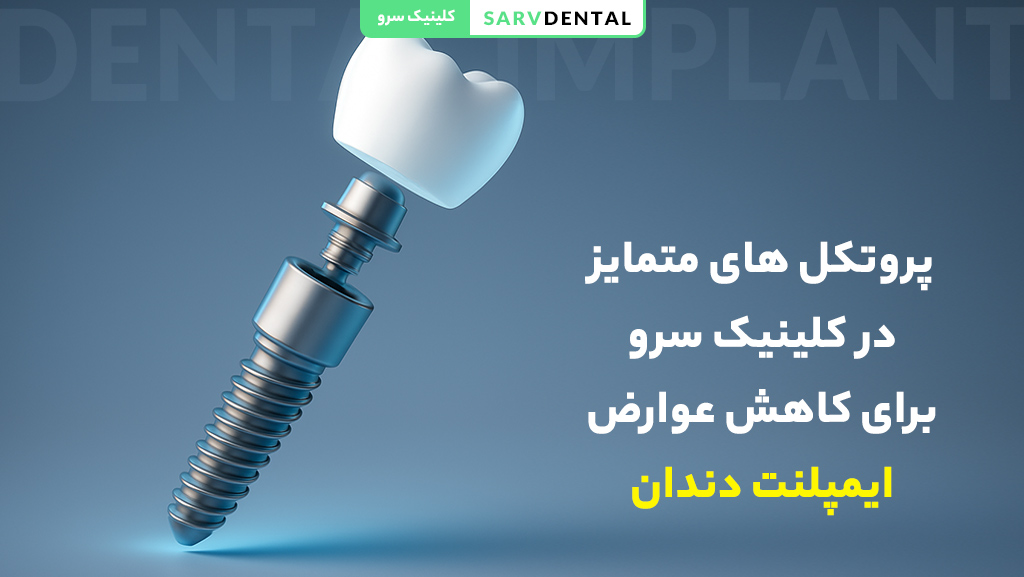 پروتکلهای متمایز کلینیک دندانپزشکی سرو برای کاهش عوارض ایمپلنت