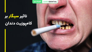 تاثیر سیگار بر کامپوزیت دندان و تغییر رنگ آن