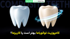 کامپوزیت توکویاما بهتر است یا کاریزما | مقایسه بهترین برندهای کامپوزیت دندان