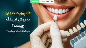 کامپوزیت دندان به روش لیرینگ چیست