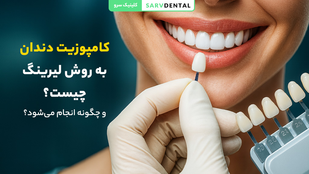 کامپوزیت دندان به روش لیرینگ چیست