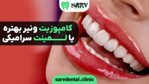 کامپوزیت ونیر بهتره یا لمینت سرامیکی