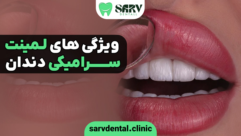 ویژگی های لمینت سرامیکی دندان