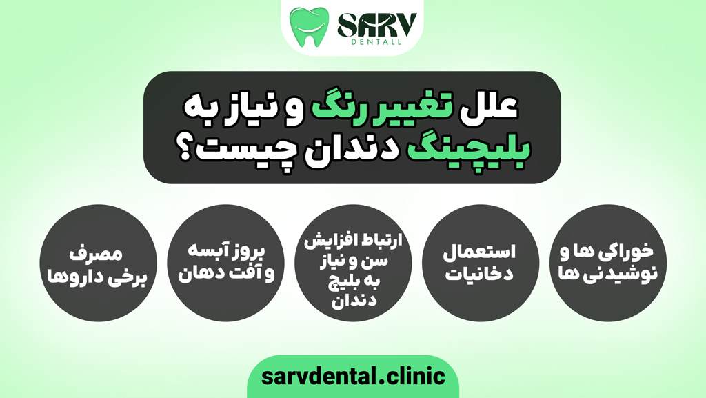 چرا نیاز به بلیچینگ دندان داریم؟