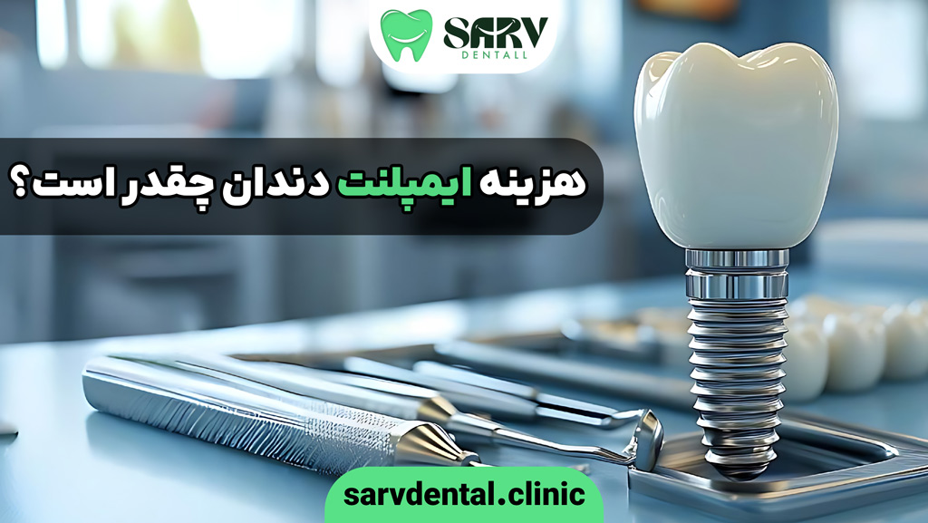 هزینه ایمپلنت دندان