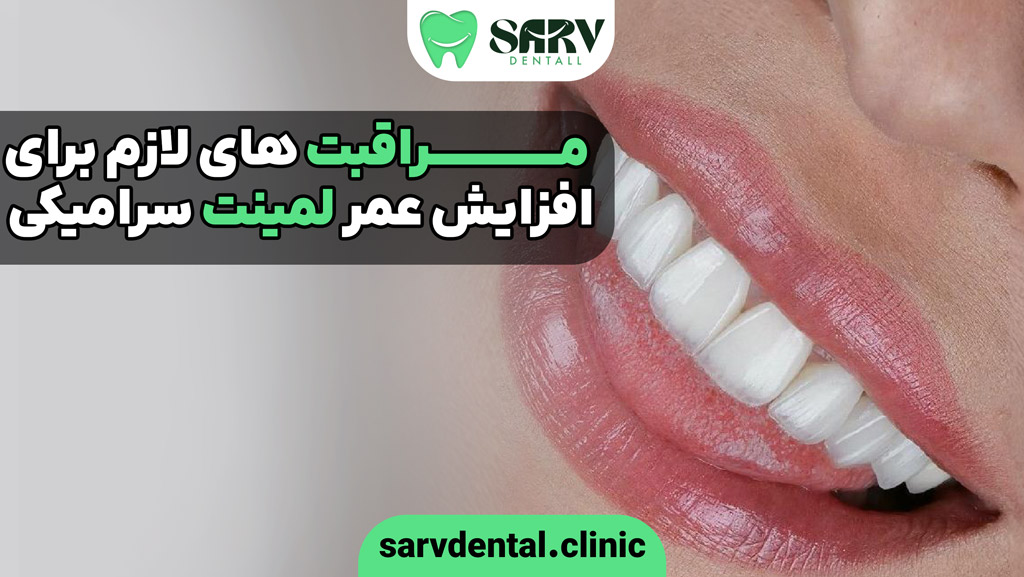 مراقبت های لازم برای افزایش عمر لمینت سرامیکی