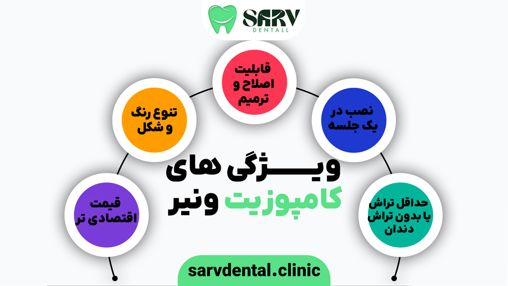 ویژگی های اصلی کامپوزیت ونیر
