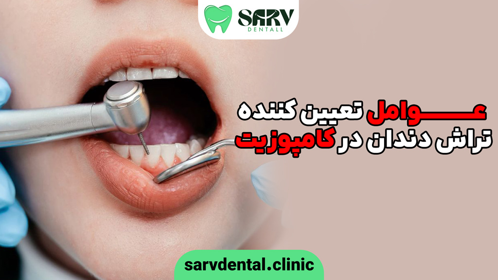 چه عواملی تعیین می کند در کامپوزیت، دندان تراش انجام شود یا خیر؟