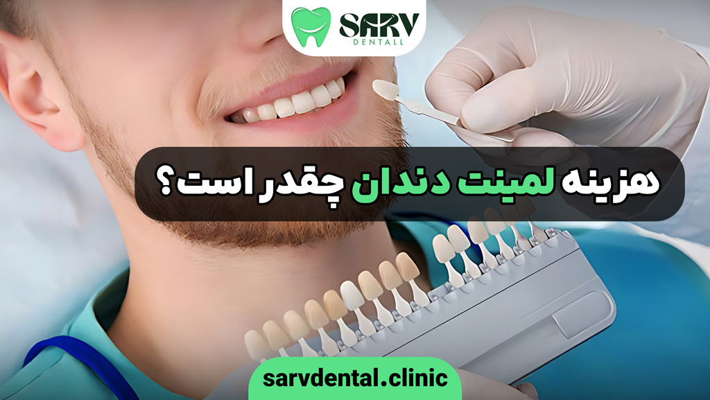 هزینه لمینت دندان چقدر است؟