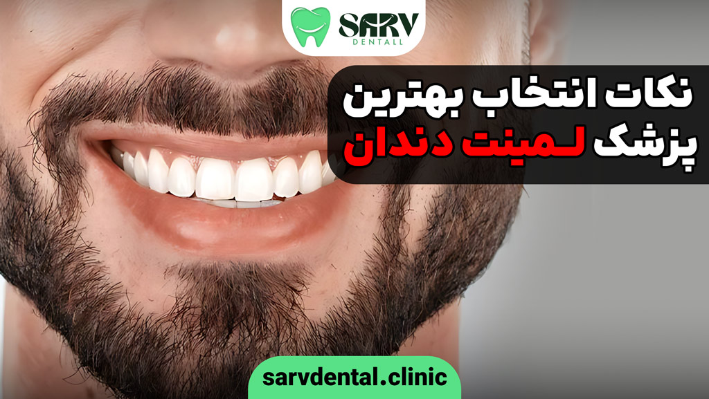 انتخاب بهترین دندانپزشک لمینت دندان