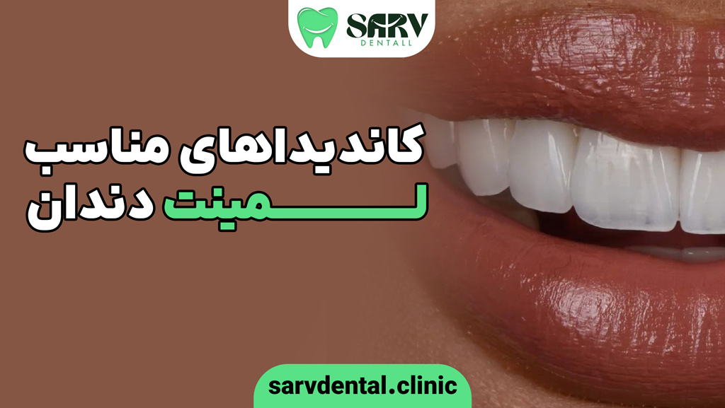 چه افرادی کاندیدای مناسب لمینت هستند؟