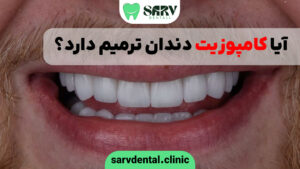 آیا کامپوزیت دندان ترمیم دارد؟