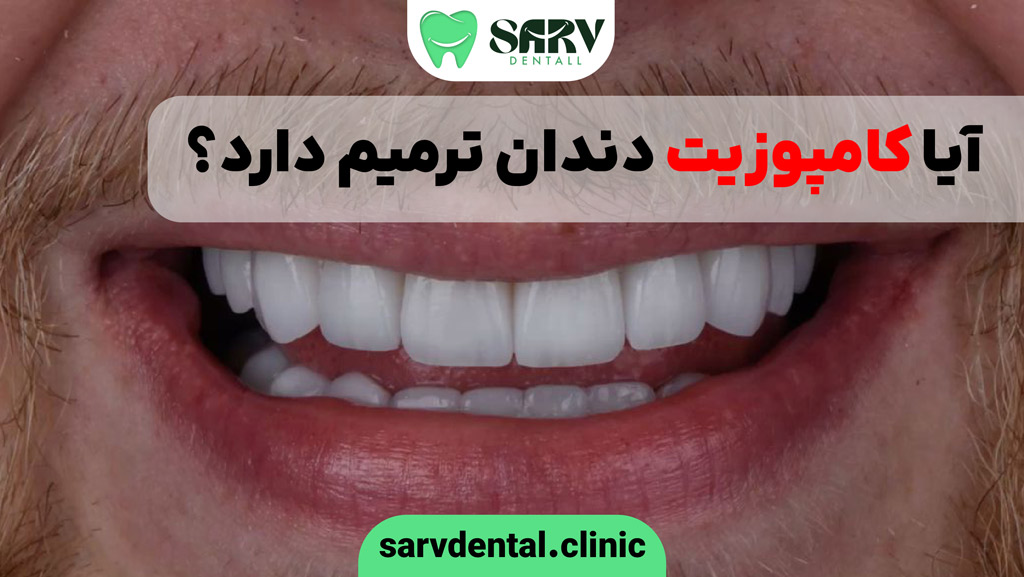 آیا کامپوزیت دندان ترمیم دارد؟