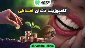 کامپوزیت دندان اقساطی