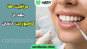 مراقبت های بعد از کامپوزیت دندان
