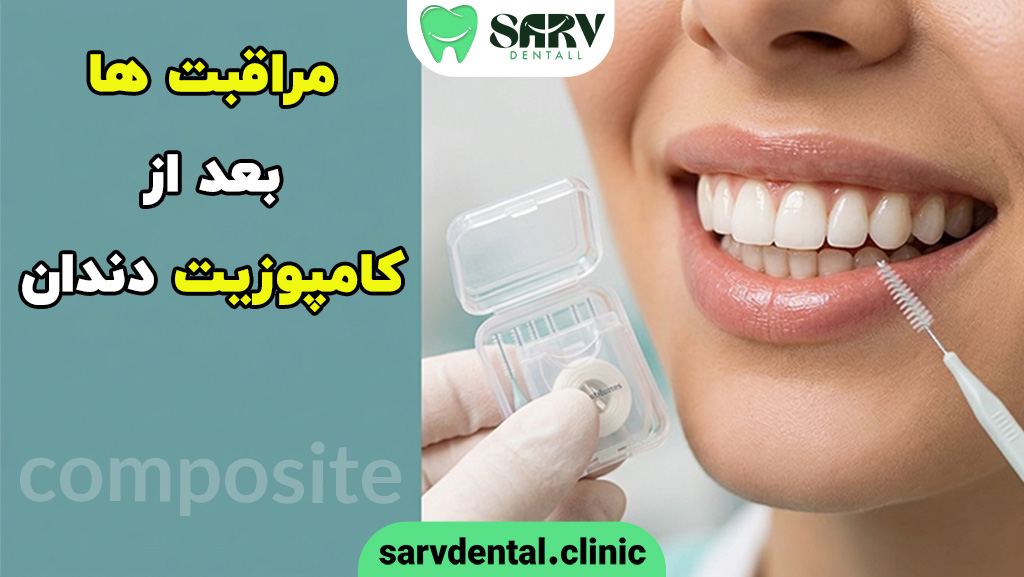 مراقبت های بعد از کامپوزیت دندان