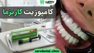 کامپوزیت کاریزما