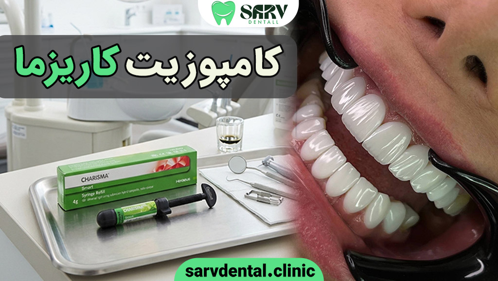 کامپوزیت کاریزما