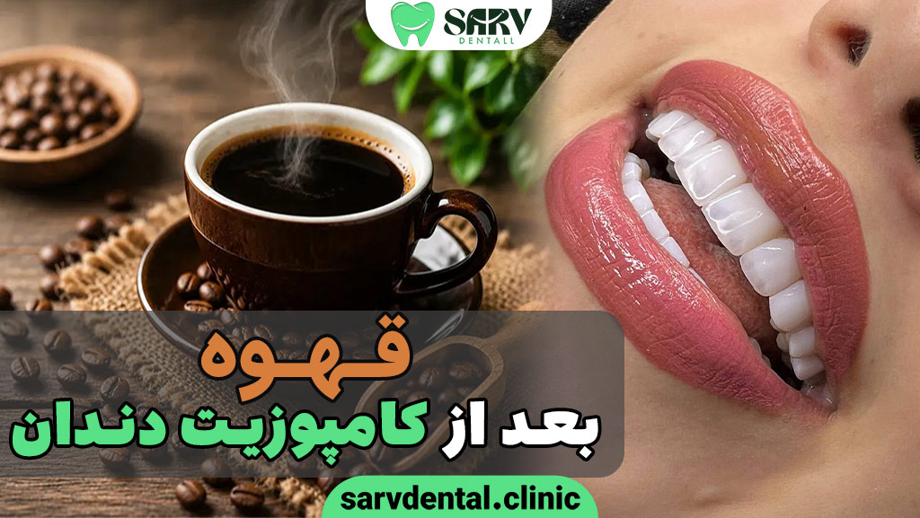 قهوه بعد از کامپوزیت دندان