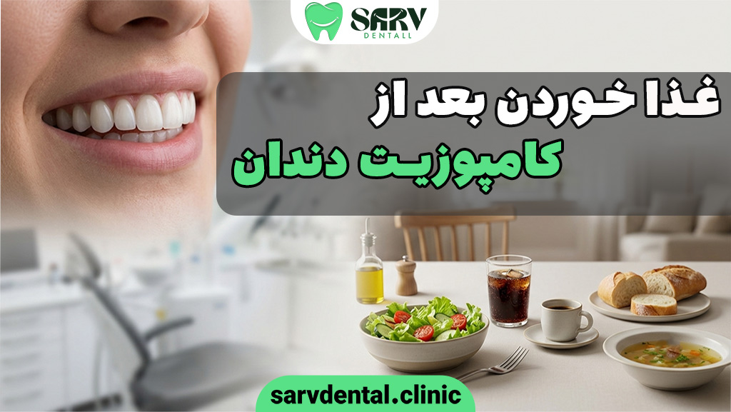 غذا خوردن بعد از کامپوزیت دندان