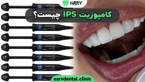 کامپوزیت IPS چیست