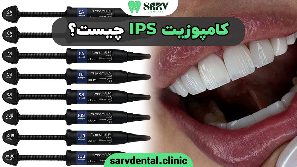 کامپوزیت IPS چیست
