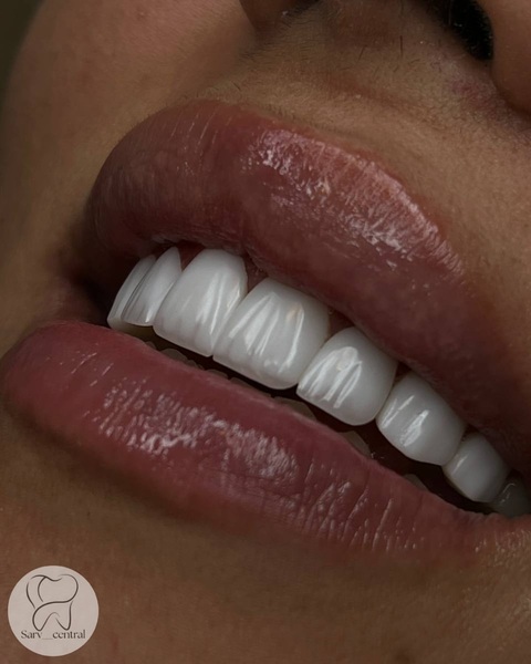 کامپوزیت سوئیسی چه ویژگیهایی دارد؟