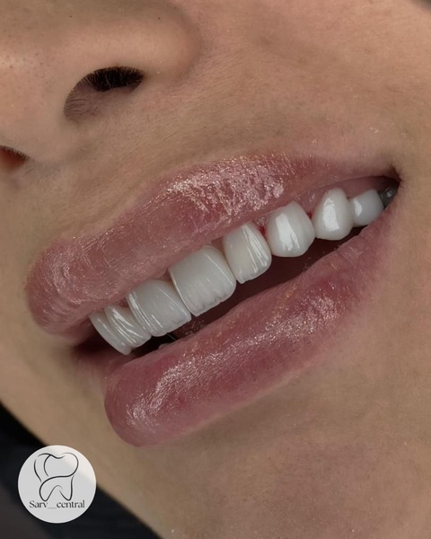 کامپوزیت سوئیسی چه کاربردهایی دارد؟