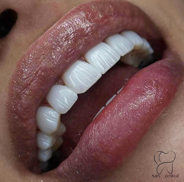 دندانپزشک چطور برند آمریکایی مناسب را انتخاب میکند؟