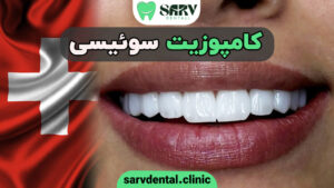 کامپوزیت سوئیسی