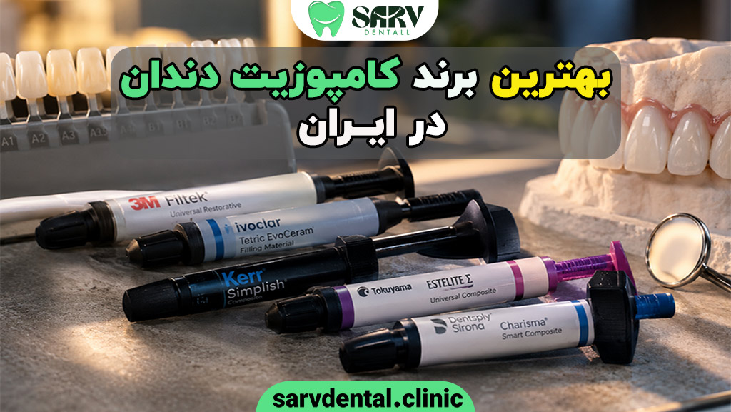 بهترین برند کامپوزیت دندان در ایران