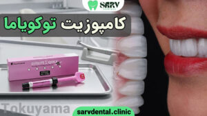 کامپوزیت توکویاما (Tokuyama)
