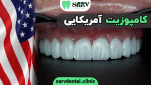 کامپوزیت آمریکایی