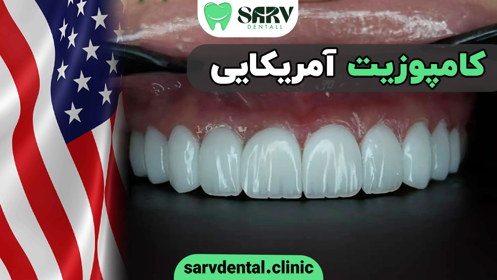کامپوزیت آمریکایی