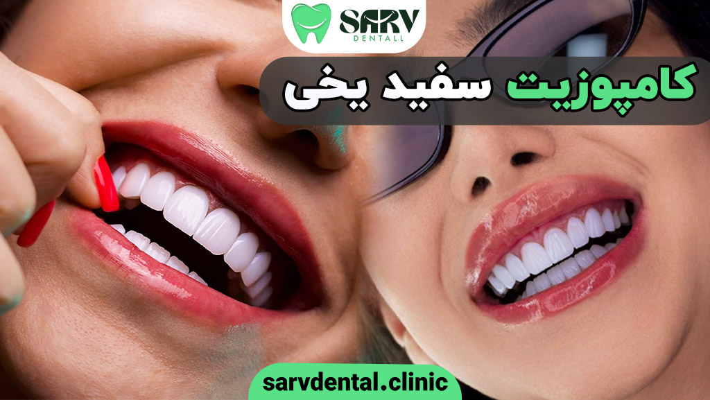 کامپوزیت سفید یخی