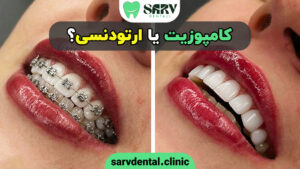 کامپوزیت یا ارتودنسی؟