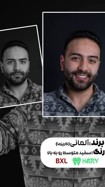 کامپوزیت آلمانی کاریزما