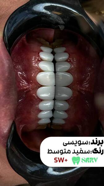 کامپوزیت سوییسی